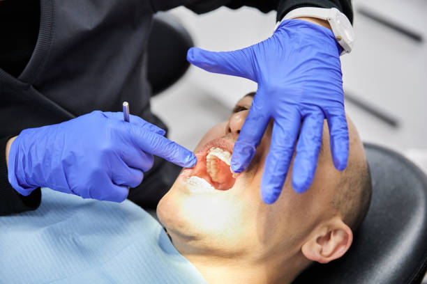 Best Broken or Cracked Tooth Emergency Dentist in Sparkill, NY